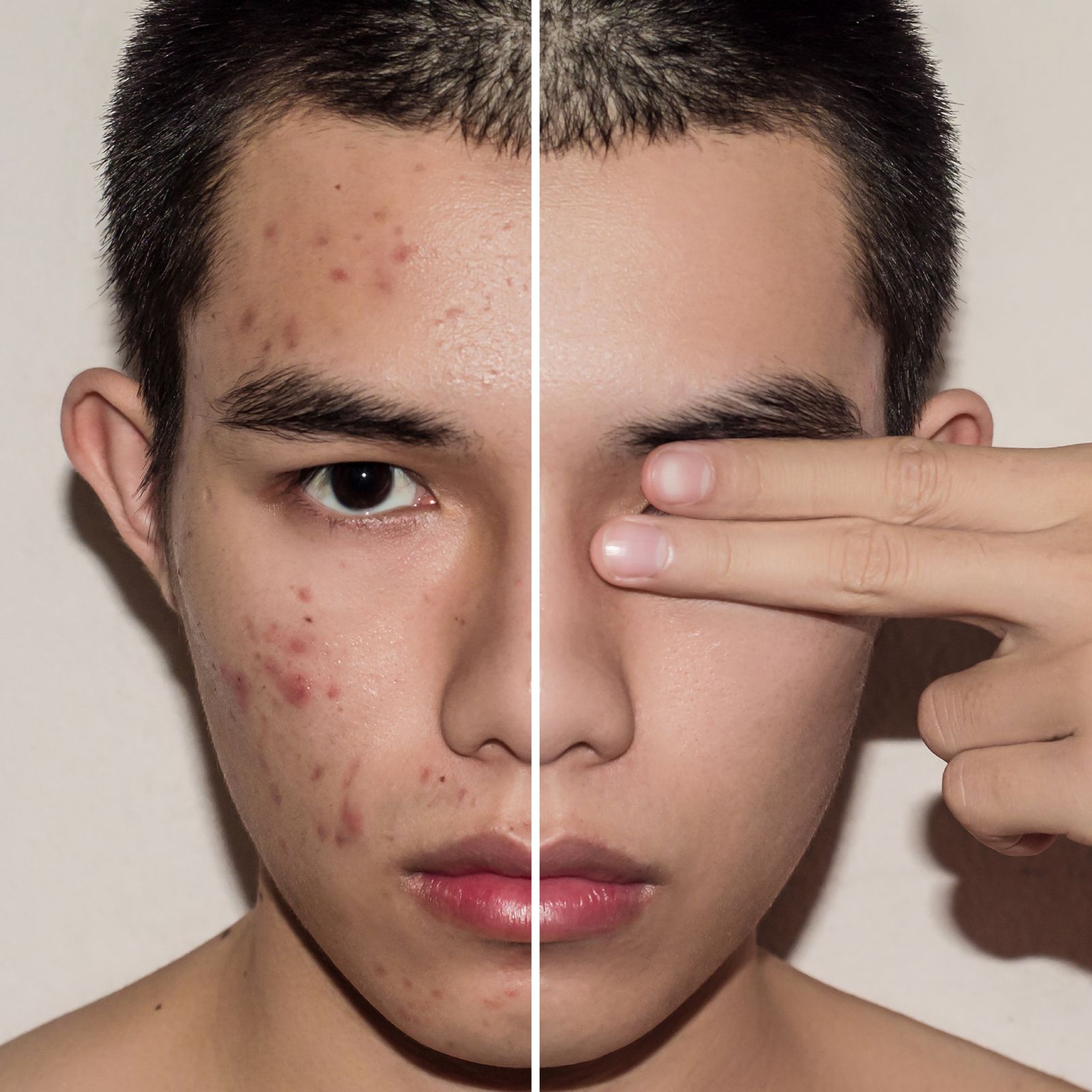 Combo RenovaPiel 360